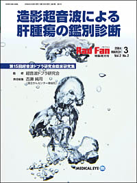 RadFan 2004年3月特集増大号