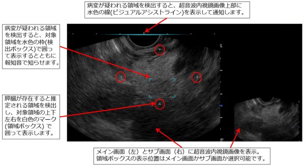 超音波内視鏡検査を支援するイメージ